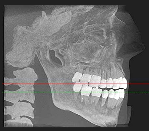 Maxillofacial Phantom Head & Dental X-Ray Cone Beam CT Panoramic Complete