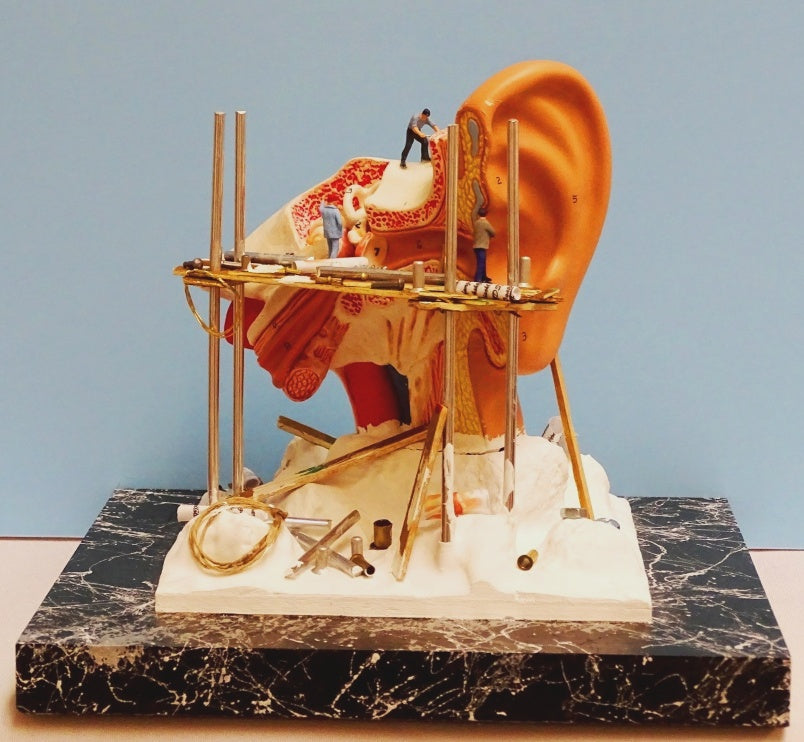 Ear Reconstruction Display