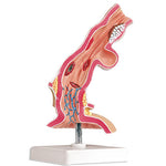 Esophagus Pathological Disease Model