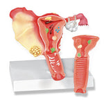 Female Reproductive System Pathologies Model