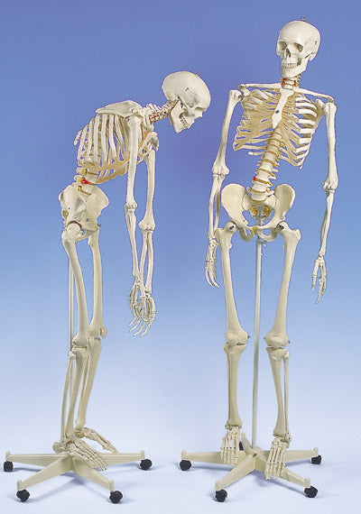 Flexible Skeleton Model   On Roller Stand