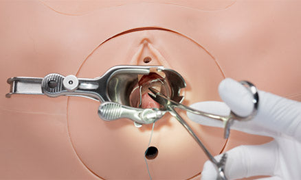 Optional Vulva Integrated Fistula