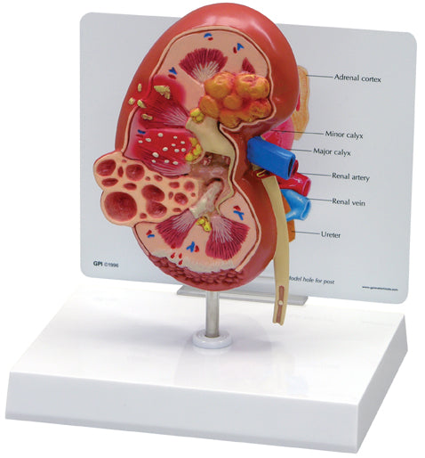 Kidney Normal & Pathology