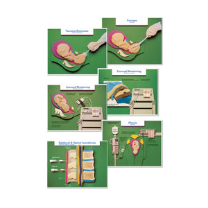 Labor Birth Intervention Charts St of 6