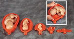 Uterus And Fetus Model Set Of 10 pc.