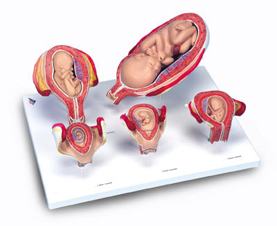 Pregnancy Human Embryo Development Model Set Of 5 Parts