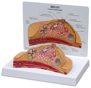 Breast Model Cross Section  Model